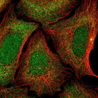 Immunocytochemistry/ Immunofluorescence ZNF14 Antibody - BSA Free