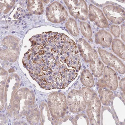 Immunohistochemistry-Paraffin ZNF14 Antibody - BSA Free