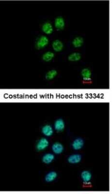 Immunocytochemistry/Immunofluorescence: ZNF143 Antibody [NBP1-32104] - Paraformaldehyde-fixed A431, using antibody at 1:500 dilution.