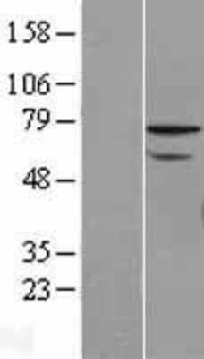 Western Blot: ZNF143 Overexpression Lysate (Adult Normal) [NBL1-18062] Left-Empty vector transfected control cell lysate (HEK293 cell lysate); Right -Over-expression Lysate for ZNF143.