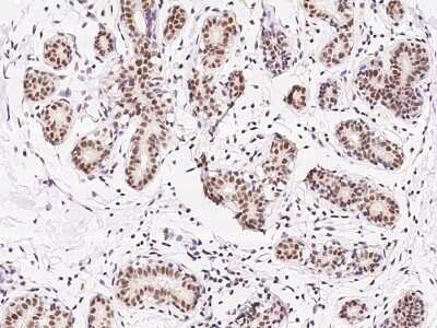 Immunohistochemistry-Paraffin: ZNF146 Antibody [NBP2-97822] - Immunochemical staining of human ZNF146 in human breast with rabbit polyclonal antibody at 1:300 dilution, formalin-fixed paraffin embedded sections.