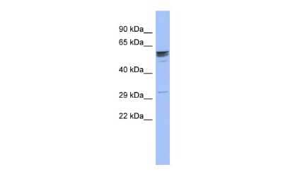Western Blot: ZNF146 Antibody [NBP2-83826] - WB Suggested Anti-ZNF146 Antibody Titration: 0.2-1 ug/ml. ELISA Titer: 1:62500. Positive Control: Human Stomach