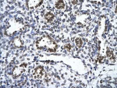 Immunohistochemistry-Paraffin: ZNF148 Antibody [NBP2-88646] - Paraffin Embedded Tissue: Human alveolar cell. Cellular Data: Epithelial cells of renal tubule. Antibody Concentration: 4.0-8.0 ug/ml. Magnification: 400X