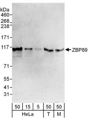 Western Blot: ZNF148 Antibody [NBP1-71872] - Whole cell lysate from HeLa (5, 15 and 50 ug), 293T (T; 50 ug) and mouse NIH3T3 (M; 50 ug) cells. Antibody used at for WB at 0.1 ug/ml.