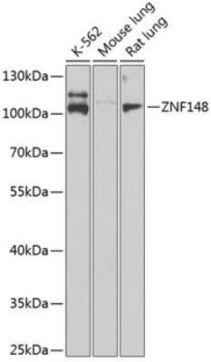 Western Blot: ZNF148 Antibody [NBP2-94521] - Analysis of extracts of various cell lines, using ZNF148 at 1:1000 dilution. Secondary antibody: HRP Goat Anti-Rabbit IgG (H+L) at 1:10000 dilution. Lysates/proteins: 25ug per lane. Blocking buffer: 3% nonfat dry milk in TBST. Detection: ECL Basic Kit . Exposure time: 60s.