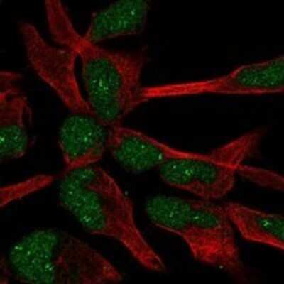 Immunocytochemistry/ Immunofluorescence ZNF154 Antibody