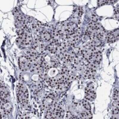 Immunohistochemistry-Paraffin ZNF154 Antibody