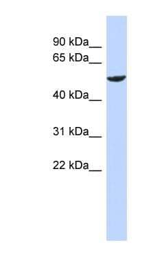 Western Blot: ZNF154 Antibody [NBP1-79273] - Human Brain lysate, concentration 0.2-1 ug/ml.