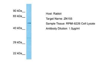 Western Blot: ZNF155 Antibody [NBP2-86438] - Host: Rabbit. Target Name: ZN155. Sample Type: RPMI-8226 Whole Cell lysates. Antibody Dilution: 1.0ug/ml