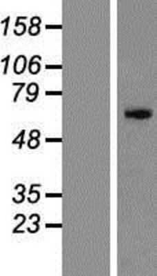 Western Blot: ZNF155 Overexpression Lysate (Adult Normal) [NBP2-09790] Left-Empty vector transfected control cell lysate (HEK293 cell lysate); Right -Over-expression Lysate for ZNF155.