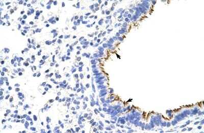 Immunohistochemistry ZNF16 Antibody - BSA Free
