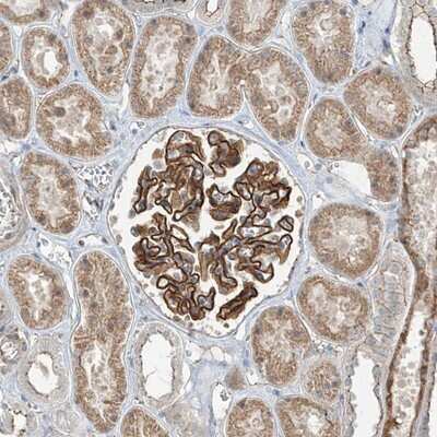 Immunohistochemistry-Paraffin ZNF16 Antibody