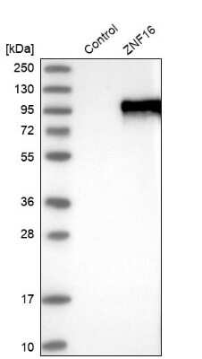 Western Blot ZNF16 Antibody