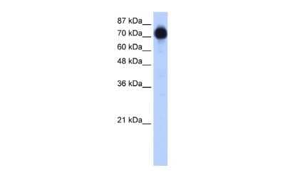 Western Blot ZNF16 Antibody - BSA Free