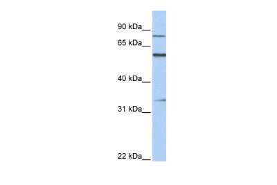 Western Blot: ZNF16 Antibody [NBP2-86441] - WB Suggested Anti-ZNF16 Antibody Titration: 0.2-1 ug/ml. ELISA Titer: 1:62500. Positive Control: Human heart
