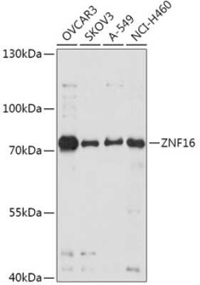 Western Blot: ZNF16 Antibody [NBP2-94230] - Analysis of extracts of various cell lines, using ZNF16 at 1:1000 dilution. Secondary antibody: HRP Goat Anti-Rabbit IgG (H+L) at 1:10000 dilution. Lysates/proteins: 25ug per lane. Blocking buffer: 3% nonfat dry milk in TBST. Detection: ECL Basic Kit . Exposure time: 10s.