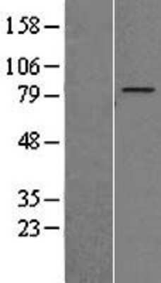 Western Blot: ZNF16 Overexpression Lysate (Adult Normal) [NBP2-08603] Left-Empty vector transfected control cell lysate (HEK293 cell lysate); Right -Over-expression Lysate for ZNF16.