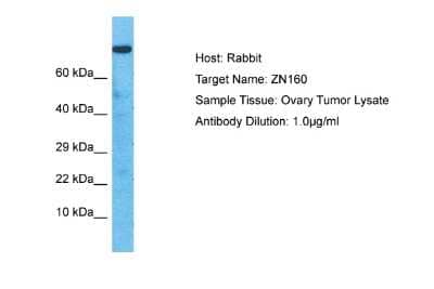 Western Blot: ZNF160 Antibody [NBP2-83829] - Host: Rabbit. Target Name: ZN160. Sample Type: Ovary Tumor lysates. Antibody Dilution: 1.0ug/ml