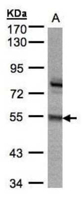 Western Blot: ZNF165 Antibody [NBP1-32507] - (30 ug whole cell lysate) A:293T 7.5% SDS PAGE diluted at 1:5000
