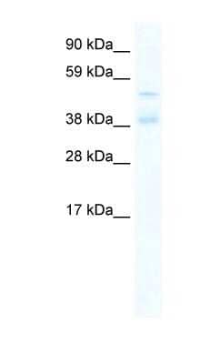Western Blot: ZNF17 Antibody [NBP1-80203] - Titration: 0.2-1 ug/ml, Positive Control: Human Small Intestine.