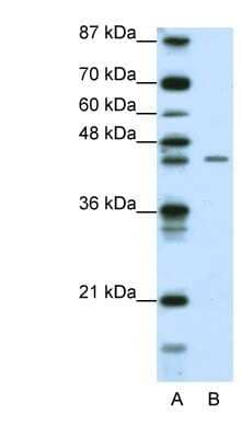 Western Blot: ZNF17 Antibody [NBP1-80317] - Jurkat cell lysate, concentration 0.2-1 ug/ml.