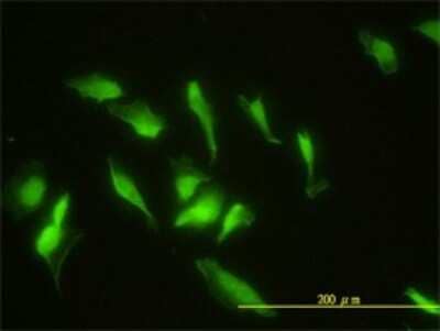 Immunocytochemistry/ Immunofluorescence ZNF174 Antibody (2D7-E9)