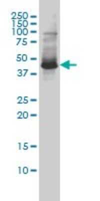 Western Blot: ZNF174 Antibody (3E4) [H00007727-M01] - ZNF174 monoclonal antibody (M01), clone 2D7-E9 Analysis of ZNF174 expression in SW-13.