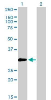 Western Blot: ZNF174 Antibody (3E4) [H00007727-M01] - Analysis of ZNF174 expression in transfected 293T cell line by ZNF174 monoclonal antibody (M01), clone 2D7-E9.Lane 1: ZNF174 transfected lysate(26 KDa).Lane 2: Non-transfected lysate.