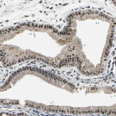 Immunohistochemistry-Paraffin: ZNF174 Antibody [NBP1-86821] - Staining of human gallbladder shows moderate nuclear positivity in glandular cells.