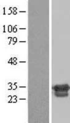 Western Blot: ZNF174 Overexpression Lysate (Adult Normal) [NBL1-18069] Left-Empty vector transfected control cell lysate (HEK293 cell lysate); Right -Over-expression Lysate for ZNF174.