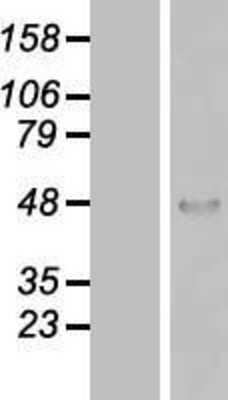 Western Blot: ZNF174 Overexpression Lysate (Adult Normal) [NBP2-08008] Left-Empty vector transfected control cell lysate (HEK293 cell lysate); Right -Over-expression Lysate for ZNF174.
