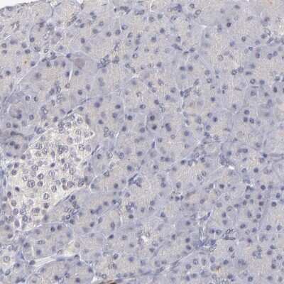 Immunohistochemistry-Paraffin ZNF177 Antibody - BSA Free