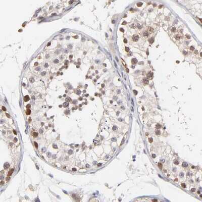 Immunohistochemistry-Paraffin ZNF177 Antibody - BSA Free