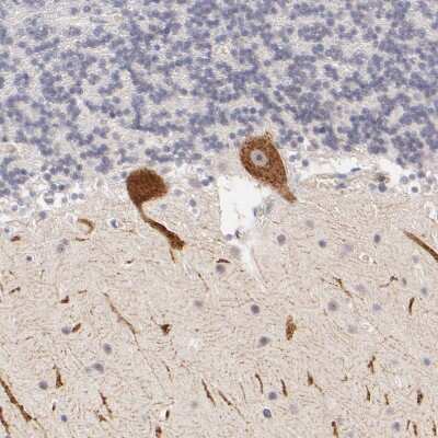 Immunohistochemistry-Paraffin ZNF177 Antibody - BSA Free