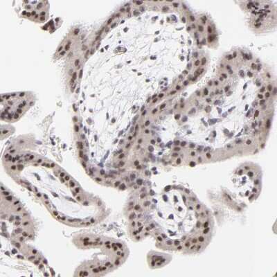 Immunohistochemistry-Paraffin ZNF177 Antibody - BSA Free
