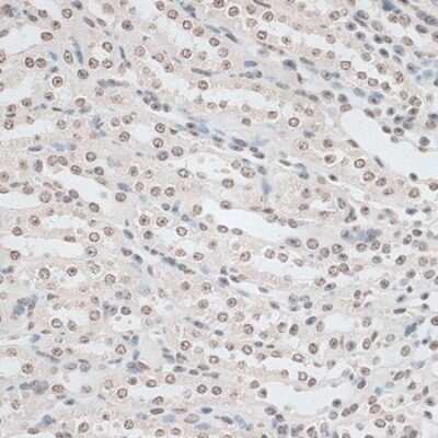 Immunohistochemistry-Paraffin ZNF177 Antibody - Azide and BSA Free
