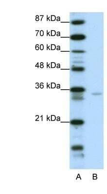 Western Blot: ZNF177 Antibody [NBP1-80299] - Transfected 293T cell lysate, concentration 0.0625ug/ml.