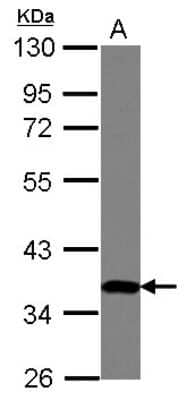Western Blot ZNF177 Antibody - BSA Free