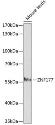 Western Blot: ZNF177 Antibody [NBP2-93871] - Analysis of extracts of mouse testis, using ZNF177 .Exposure time: 2.5min.