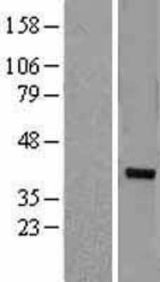 Western Blot ZNF177 Overexpression Lysate
