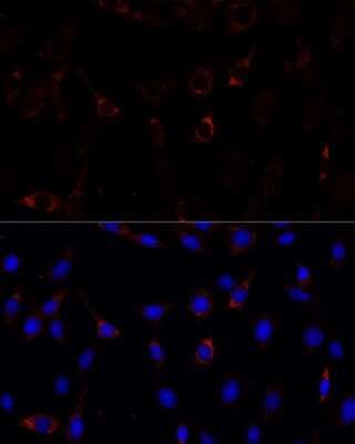 Immunocytochemistry/Immunofluorescence: ZNF179 Antibody [NBP2-93335] - Analysis of C6 cells using ZNF179 at dilution of 1:100. Blue: DAPI for nuclear staining.