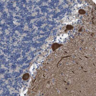 Immunohistochemistry-Paraffin: ZNF179 Antibody [NBP2-13236] - Staining of human cerebellum shows strong cytoplasmic positivity in purkinje cells.