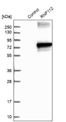 Western Blot: ZNF179 Antibody [NBP2-13236] - Analysis in control (vector only transfected HEK293T lysate) and RNF112 over-expression lysate (Co-expressed with a C-terminal myc-DDK tag (3.1 kDa) in mammalian HEK293T cells).