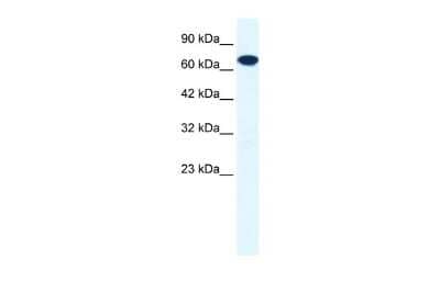 Western Blot: ZNF179 Antibody [NBP2-86448] - WB Suggested Anti-ZNF179 Antibody Titration: 0.2-1 ug/ml. ELISA Titer: 1:62500. Positive Control: HepG2 cell lysate