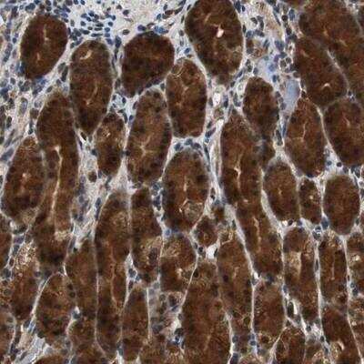 Immunohistochemistry ZNF18 Antibody - BSA Free