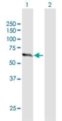 Western Blot: ZNF18 Antibody [H00007566-B01P] - Analysis of ZNF18 expression in transfected 293T cell line by ZNF18 polyclonal antibody.  Lane 1: ZNF18 transfected lysate(60.39 KDa). Lane 2: Non-transfected lysate.