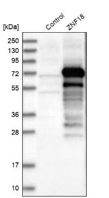 Western Blot ZNF18 Antibody - BSA Free