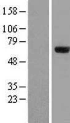Western Blot: ZNF18 Overexpression Lysate (Adult Normal) [NBL1-18072] Left-Empty vector transfected control cell lysate (HEK293 cell lysate); Right -Over-expression Lysate for ZNF18.