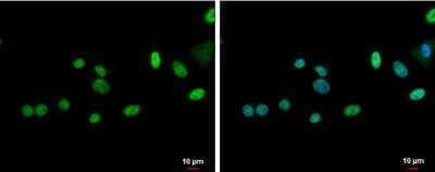 Immunocytochemistry/Immunofluorescence: ZNF181 Antibody [NBP2-20967] - A549 cells were fixed in 4% paraformaldehyde at RT for 15 min. Green: ZNF181 protein stained by ZNF181 antibody diluted at 1:500. Blue: Hoechst 33342 staining. Scale bar = 10 um.