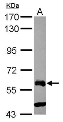 Western Blot: ZNF181 Antibody [NBP2-20967] - Sample (30 ug of whole cell lysate) A: Raji 7. 5% SDS PAGE gel, diluted at 1:1000.